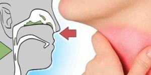 بكتيرية أم فيروسية.. كيف يشير لون المخاط إلى نوع العدوى؟