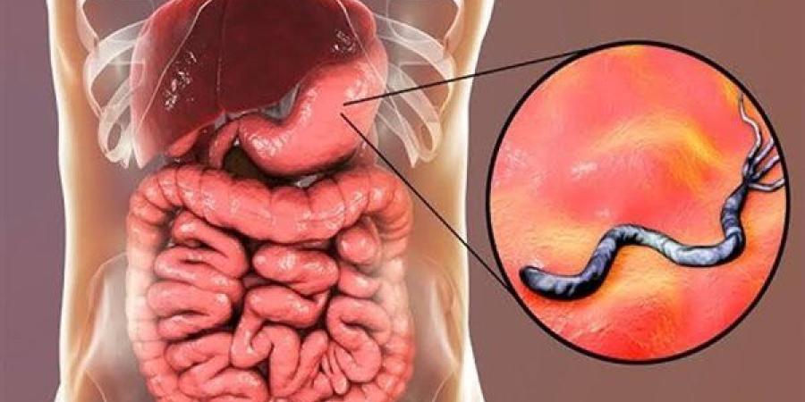 مخاطر جرثومة المعدة وطرق علاجها