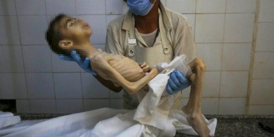 الأمم المتحدة: غزة المكان الأكثر جوعا في العالم