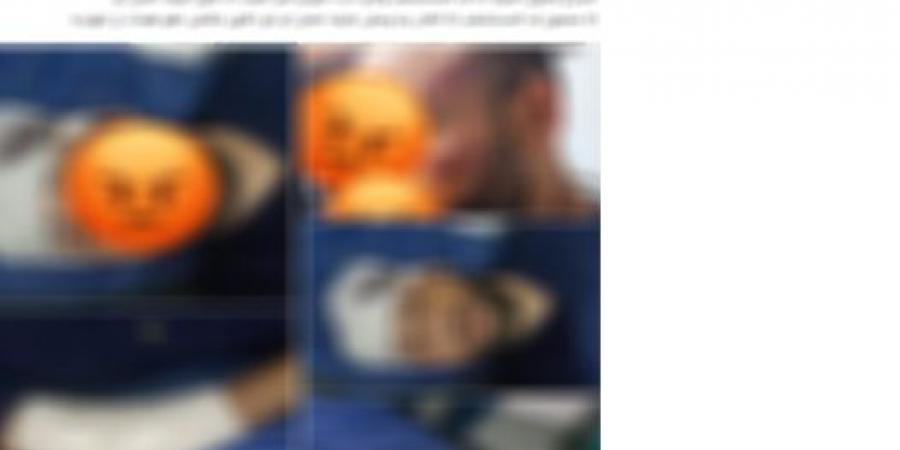 الداخلية تكشف حقيقة ادعاء فني تمريض بالتعدى عليه فى الإسماعيلية