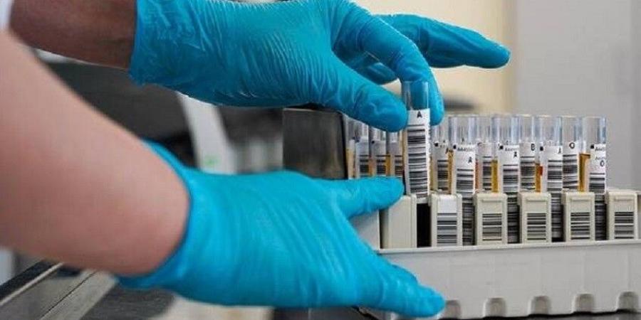 روسيا تطور لقاحات ضد السرطان .. تفاصيل